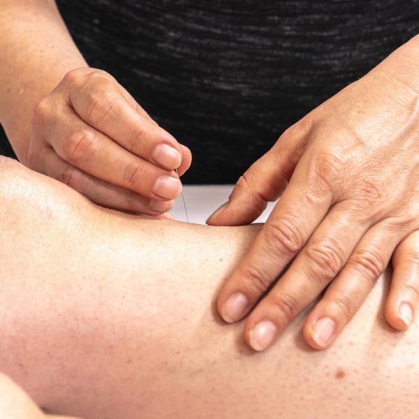 Uddrag hagl Kalksten Skinnebensbetændelse behandling med akupunktur - Hørsholm Akupunktur